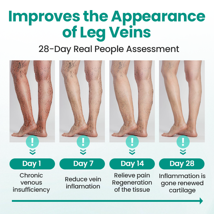Juxek® LegRenew Varicose Veins Patch