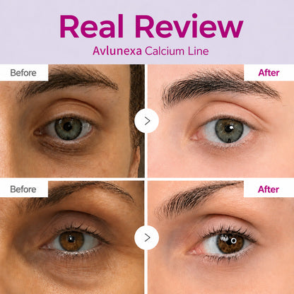 🔥LAST DAY 50% OFF!!Avlunexa Korean Calcium Dark Spot Eye Cream