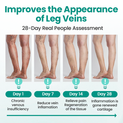 Juxek® LegRenew Varicose Veins Patch